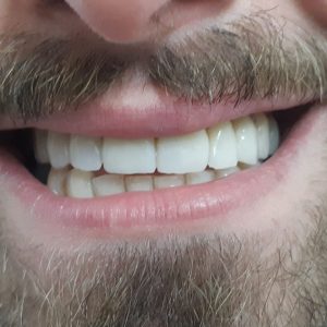 Dopo